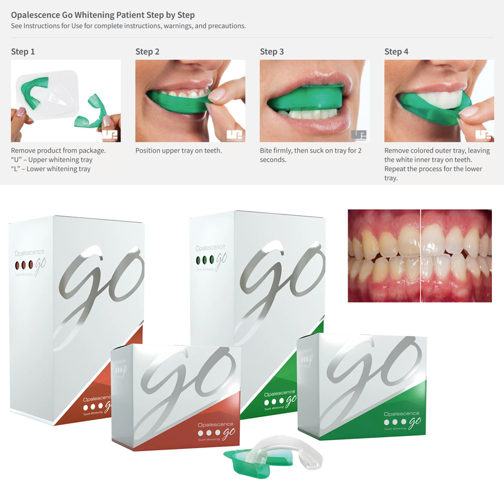 Teeth Whitening Opalescence Go - Opalescence Go Teeth Whitening Trays Prefilled