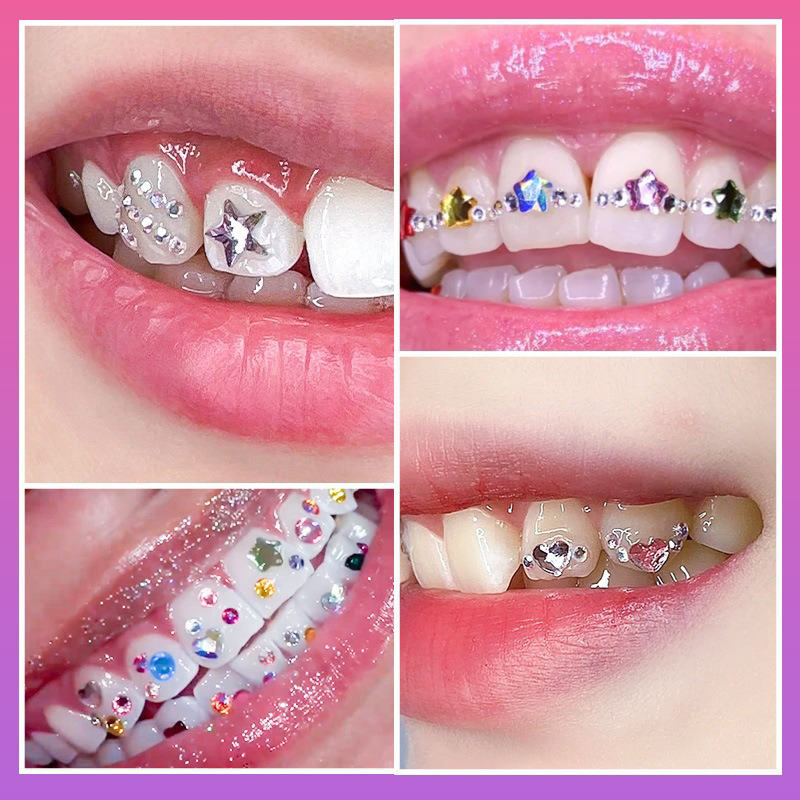 NEW Professional Tooth Gem Kit – Tooth Gem Kit recenzja i cena