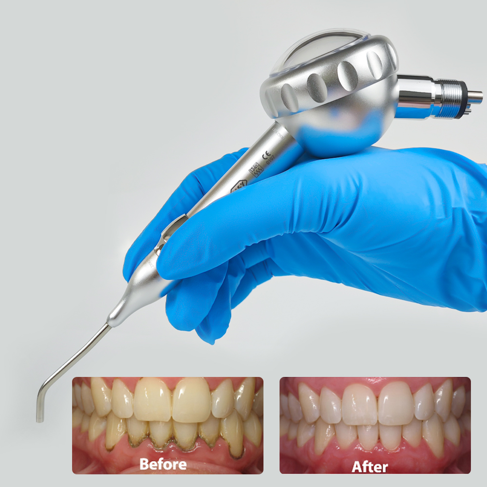 Dental Air Prophy Handpiece Un – Colgate Whitening Teeth recenzja i cena