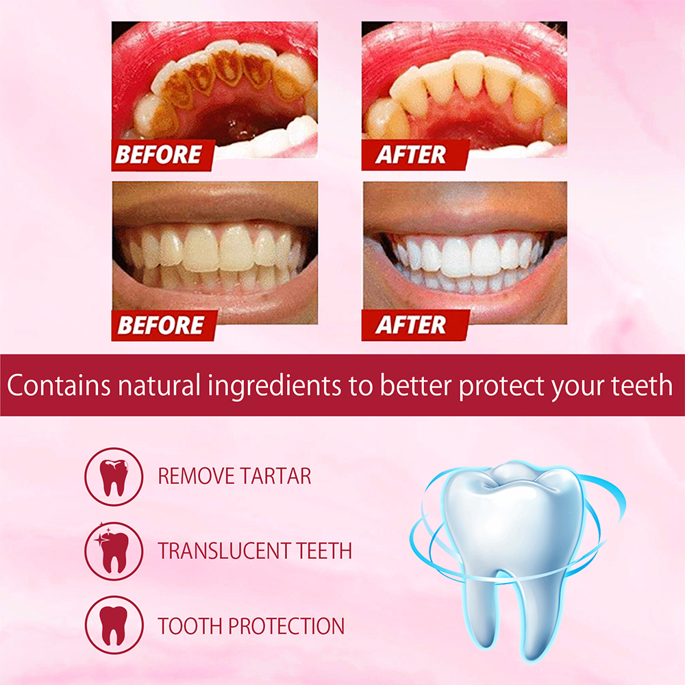 SP-4 Probiotic Whitening Tooth – Teeth Whitening Enzymes recenzja i cena