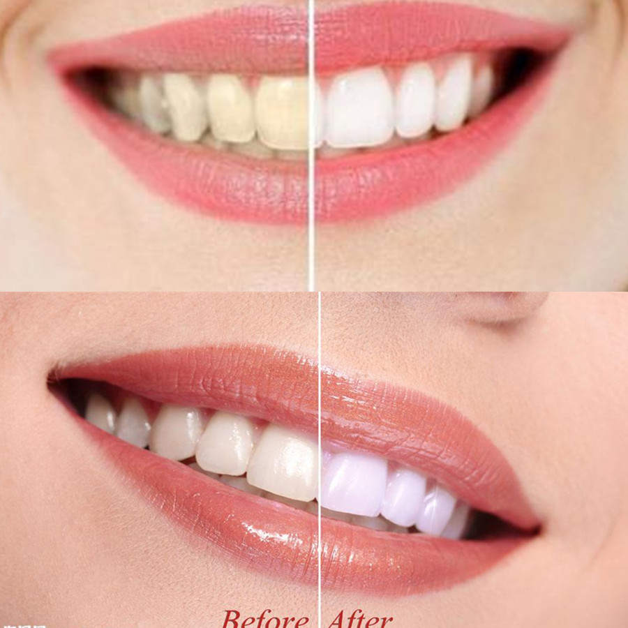 Bamboo Charcoal Teeth Tooth De – Teeth Whitening Flash recenzja i cena
