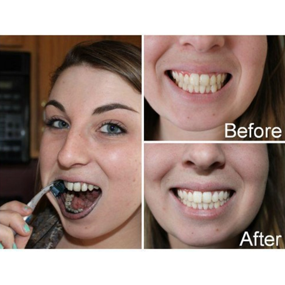 Bamboo Charcoal Teeth Tooth De – Teeth Whitening Flash recenzja i cena