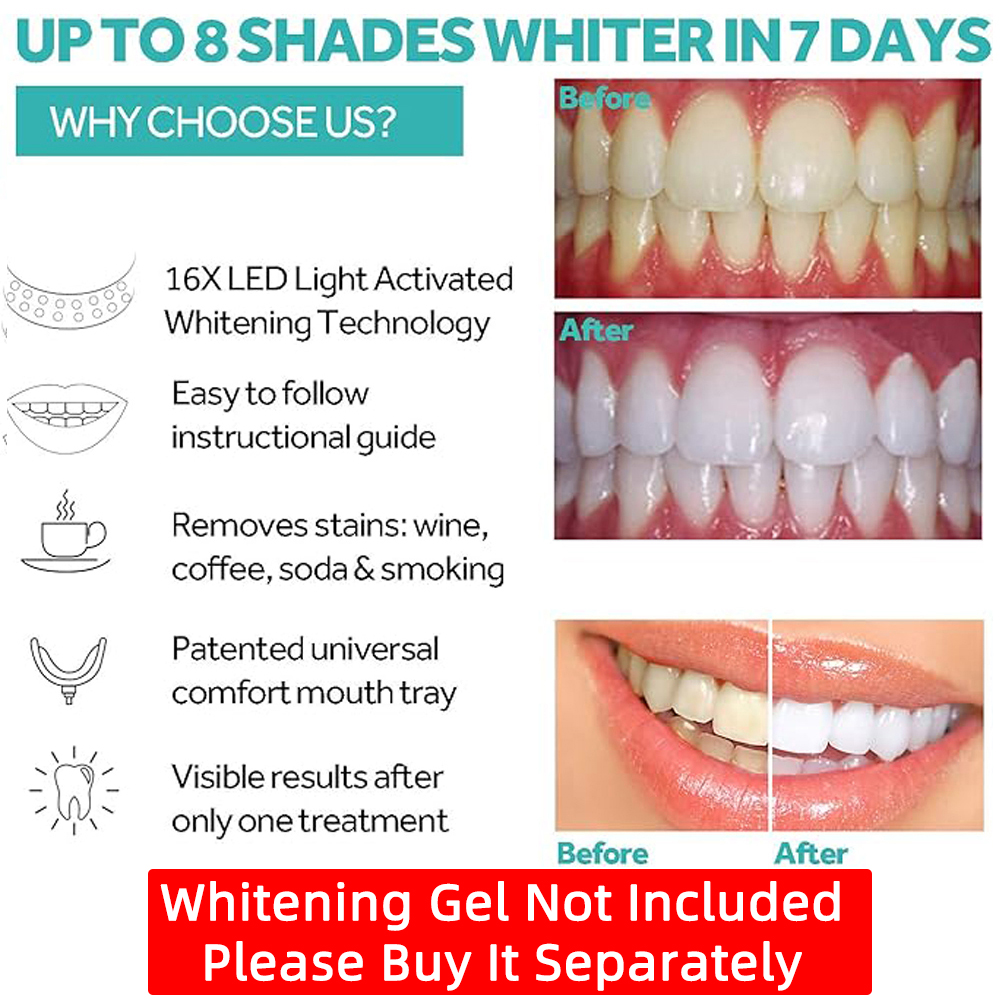 Vaclav Teeth Whitening Light K – Teeth Whitening Uv Light recenzja i cena