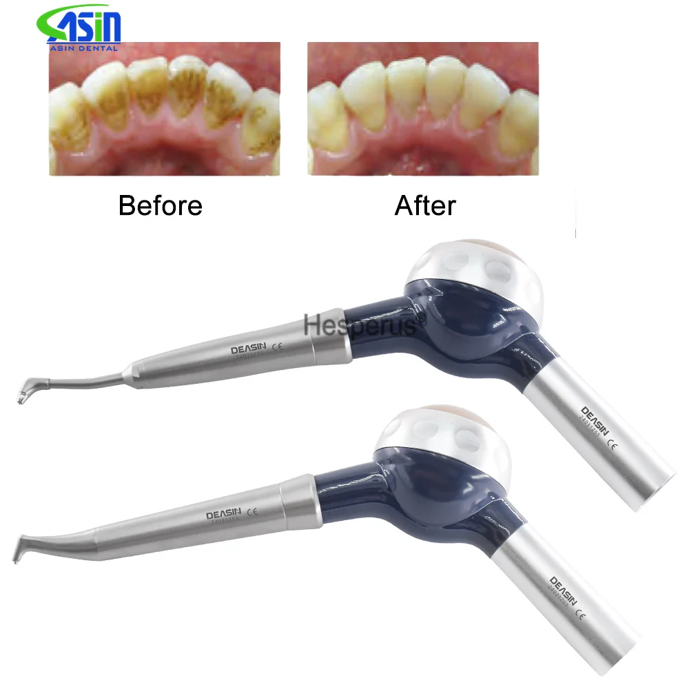 Teeth Whitening Spray Dental A – Colgate Whitening Teeth recenzja i cena