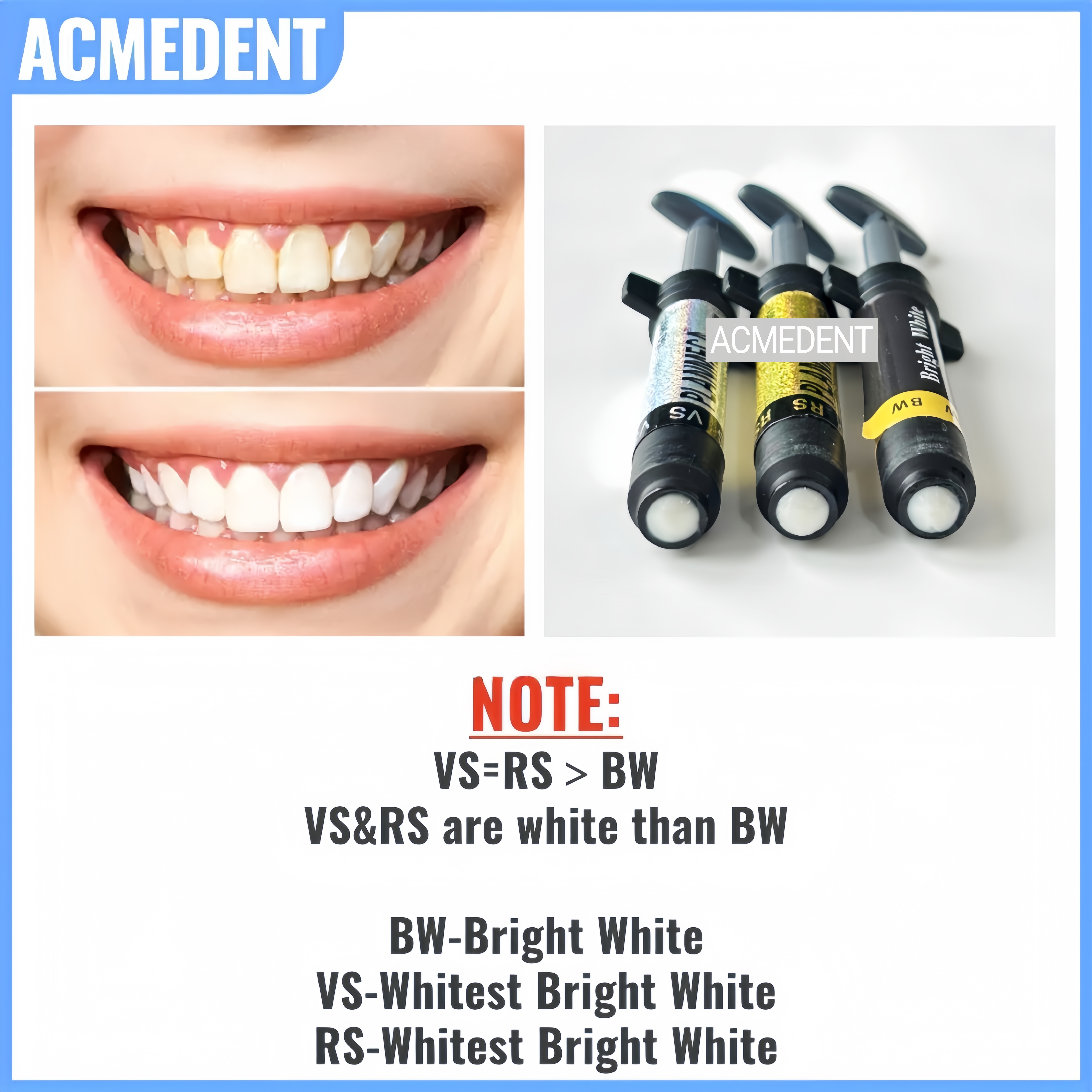 4.5g VS Dental Light Cure Hybr – Teeth Whitening Vs Veneers recenzja i cena