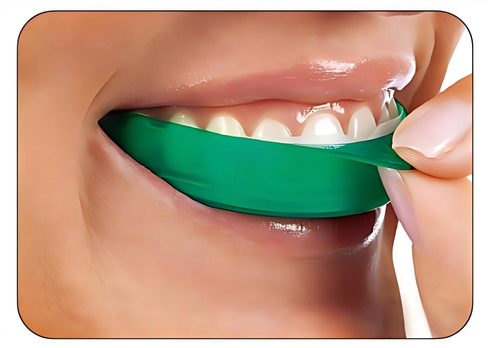 Ultradent Opalescence Go Teeth – Teeth Whitening Opalescence Go recenzja i cena