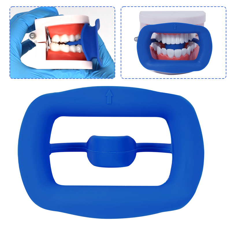 1pc Dental Mouth Opener Soft S – Teeth Whitening Zoom recenzja i cena