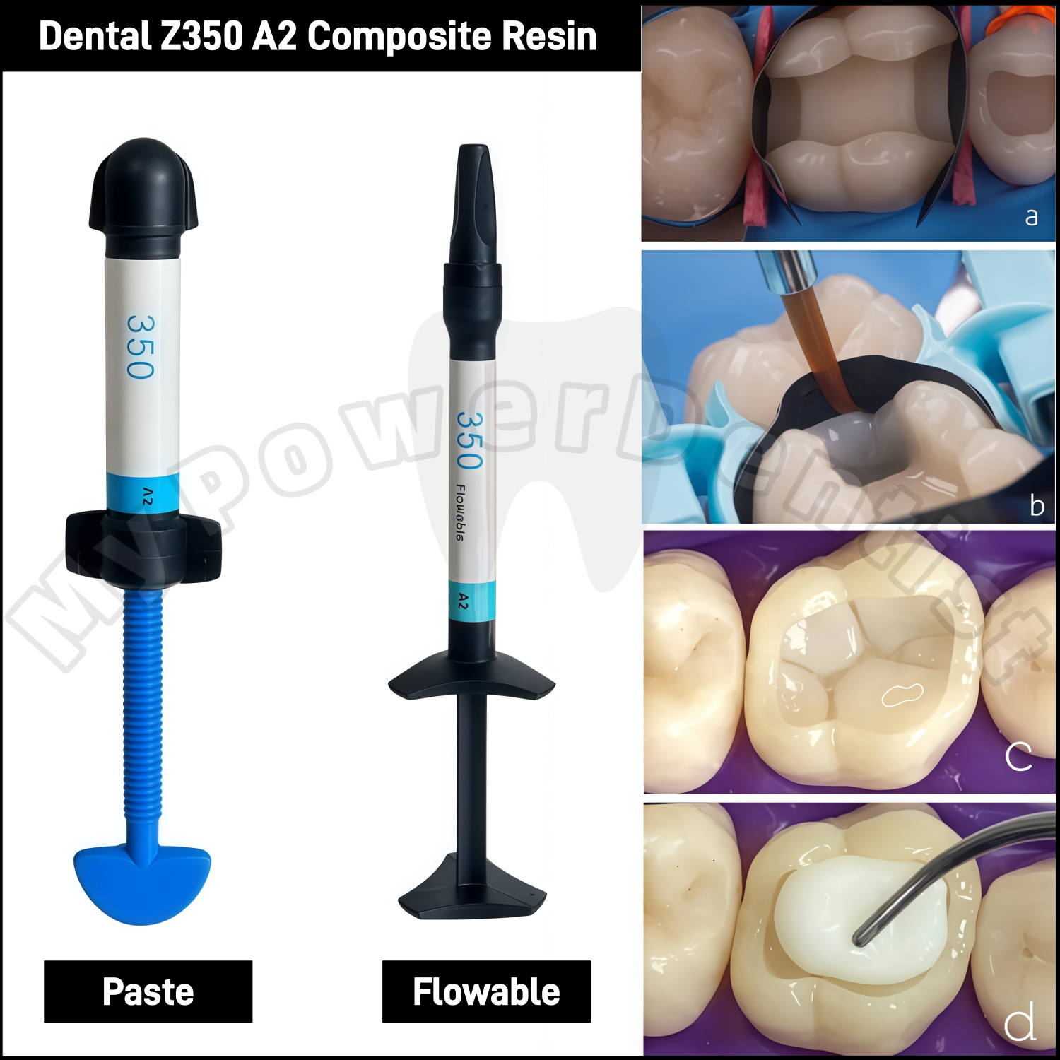 Z350 A2  Dental Composite Resi – Teeth Whitening Veneers recenzja i cena