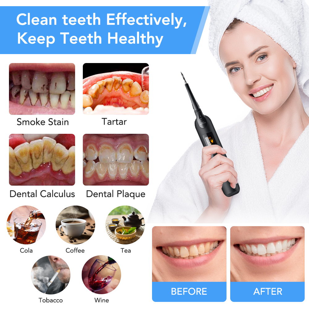 Teeth Tartar Remover Electric  – Teeth Whitening Zoom recenzja i cena