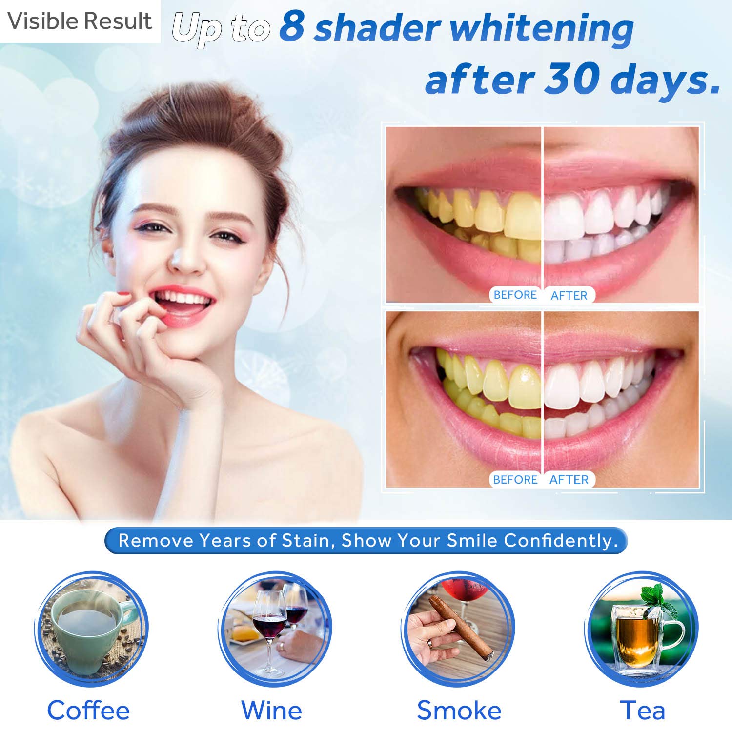 Teeth Whitening Gel Refill Syr – Teeth Whitening Uv Light recenzja i cena