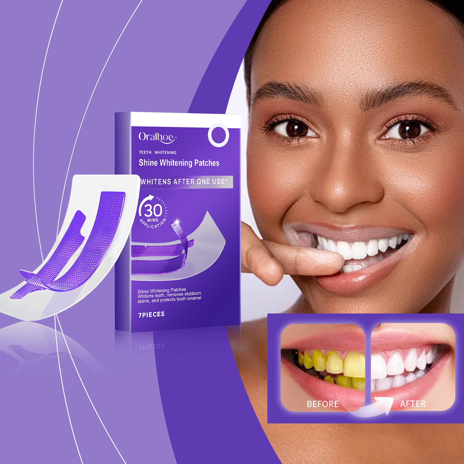Purple Teeth Whitening Strips  – Teeth Whitening Flash recenzja i cena