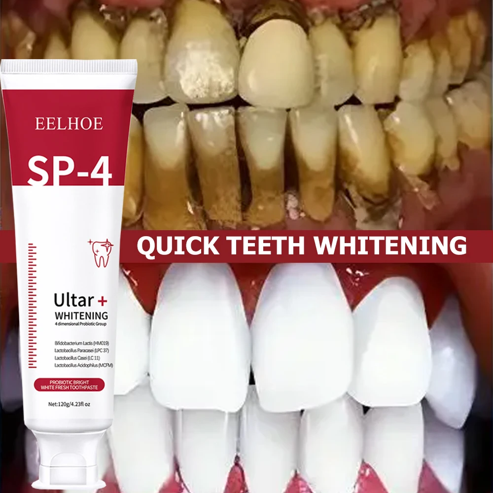 5pcs Sp-4 120g Probiotic White – Teeth Whitening Enzymes recenzja i cena