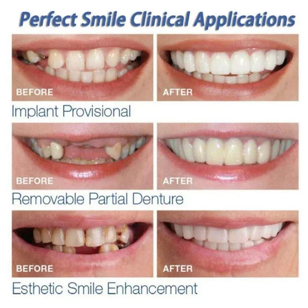 Best Sellers  Teeth Kit Fake T – Teeth Whitening Session recenzja i cena