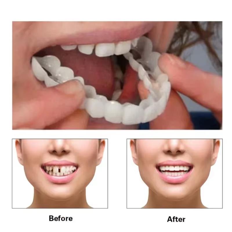 Best Sellers  Teeth Kit Fake T – Teeth Whitening Session recenzja i cena