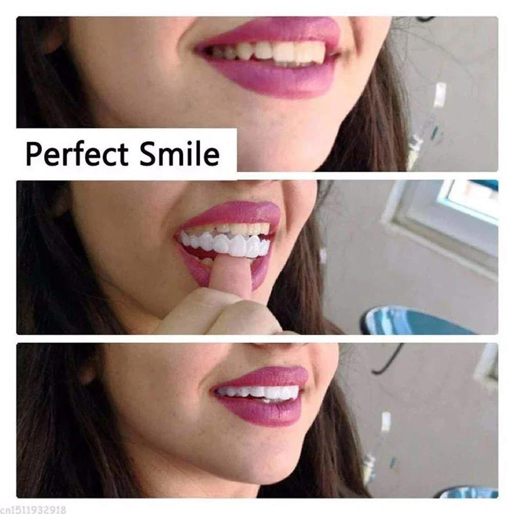 Best Sellers  Teeth Kit Fake T – Teeth Whitening Session recenzja i cena