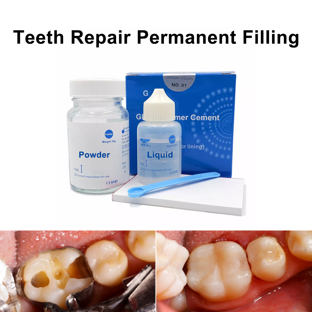 Permanent Teeth Filling Repair – Teeth Whitening At Home Kit recenzja i cena