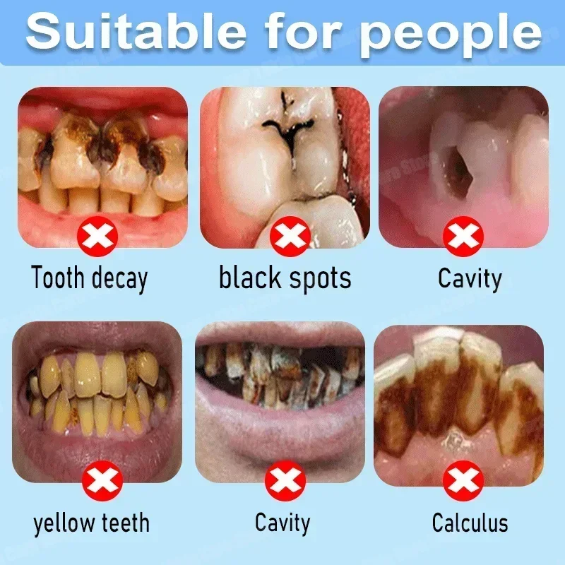 Anti Decay Toothpaste repairs  – Teeth Whitening Toothpaste recenzja i cena