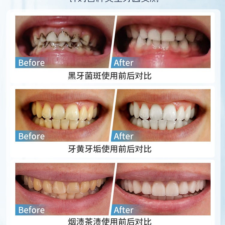 Japan Manual Tooth Stain Remov – Teeth Whitening In Japan recenzja i cena