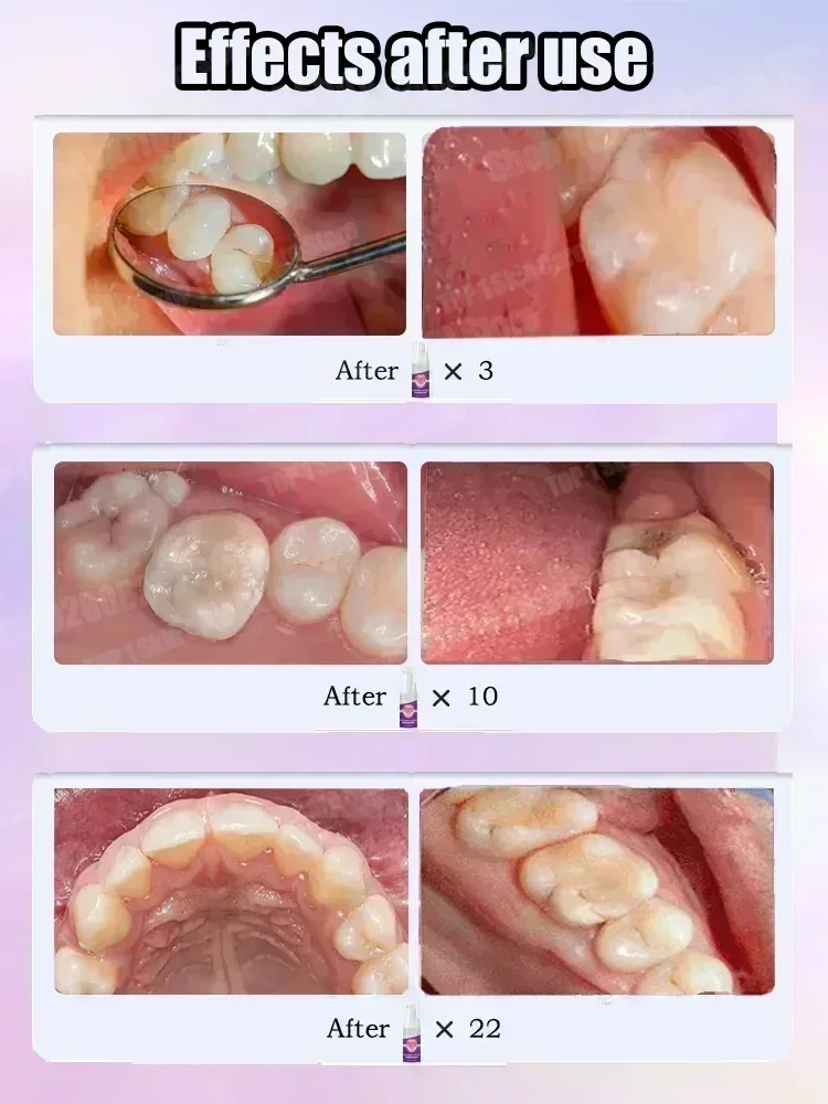 Hot sales Best-selling, Scient – Teeth Whitening Toothpaste recenzja i cena