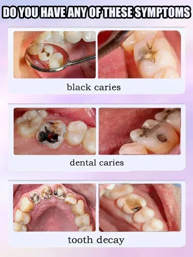 Hot sales Best-selling, Scient – Teeth Whitening Toothpaste recenzja i cena