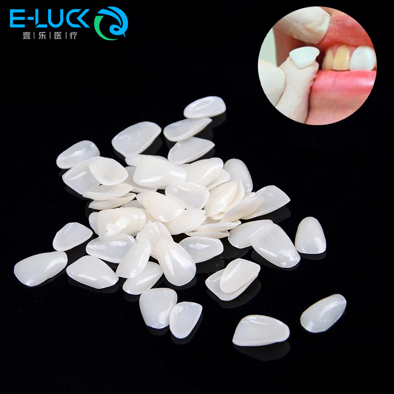 50pcs Dental Teeth Veneers Tem – Teeth Whitening Veneers recenzja i cena