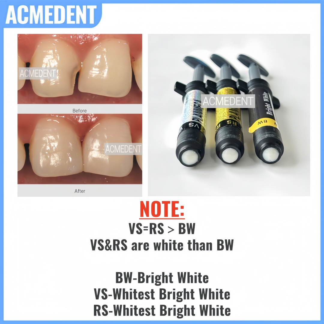 4.5g Dental Composite Resin Ve – Teeth Whitening Vs Veneers recenzja i cena