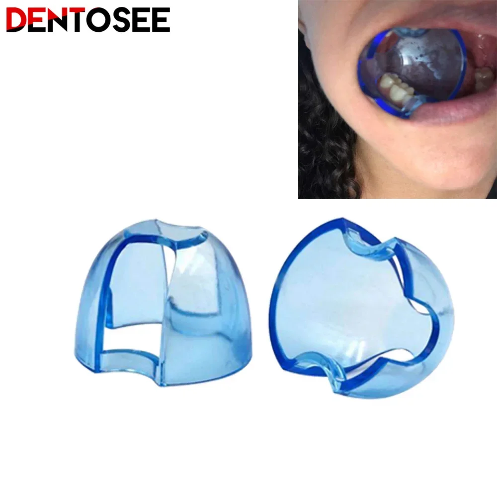 Dental Intraoral Cheek Retract – Teeth Whitening Zoom recenzja i cena