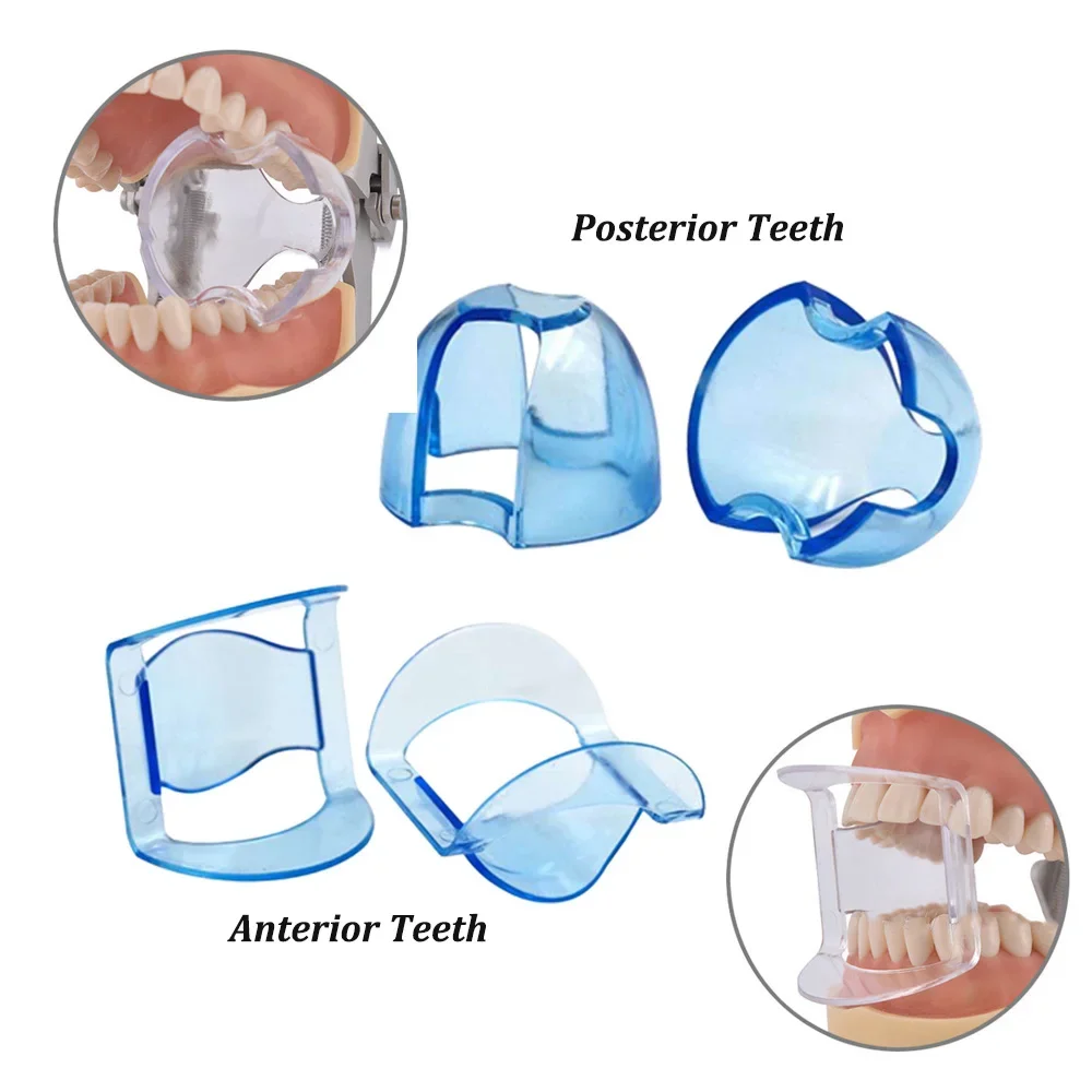 Dental Intraoral Cheek Retract – Teeth Whitening Zoom recenzja i cena