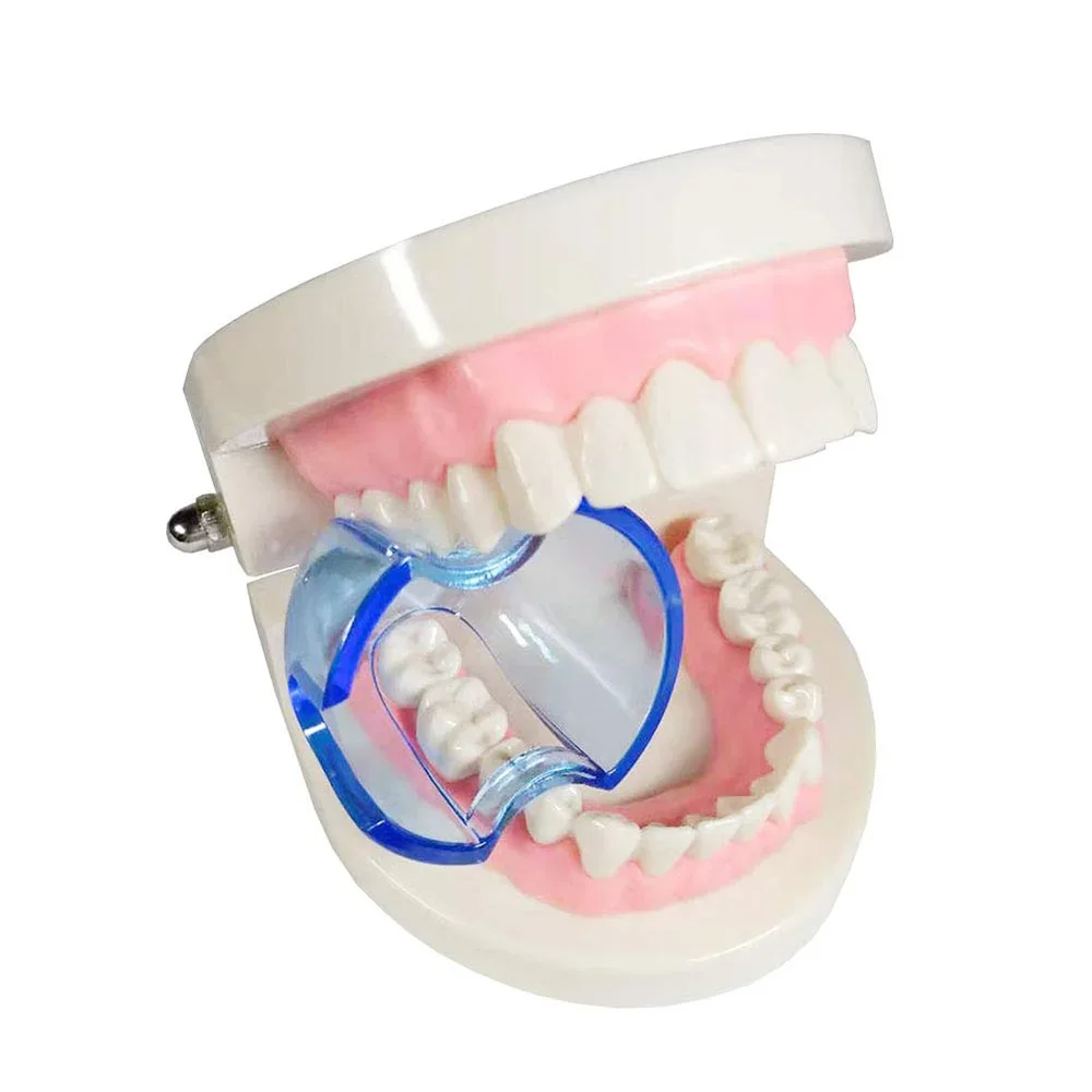 Dental Intraoral Cheek Retract – Teeth Whitening Zoom recenzja i cena