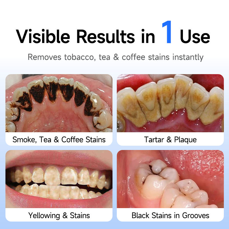 Electric Tooth Polisher Low No – Teeth Whitening Session recenzja i cena