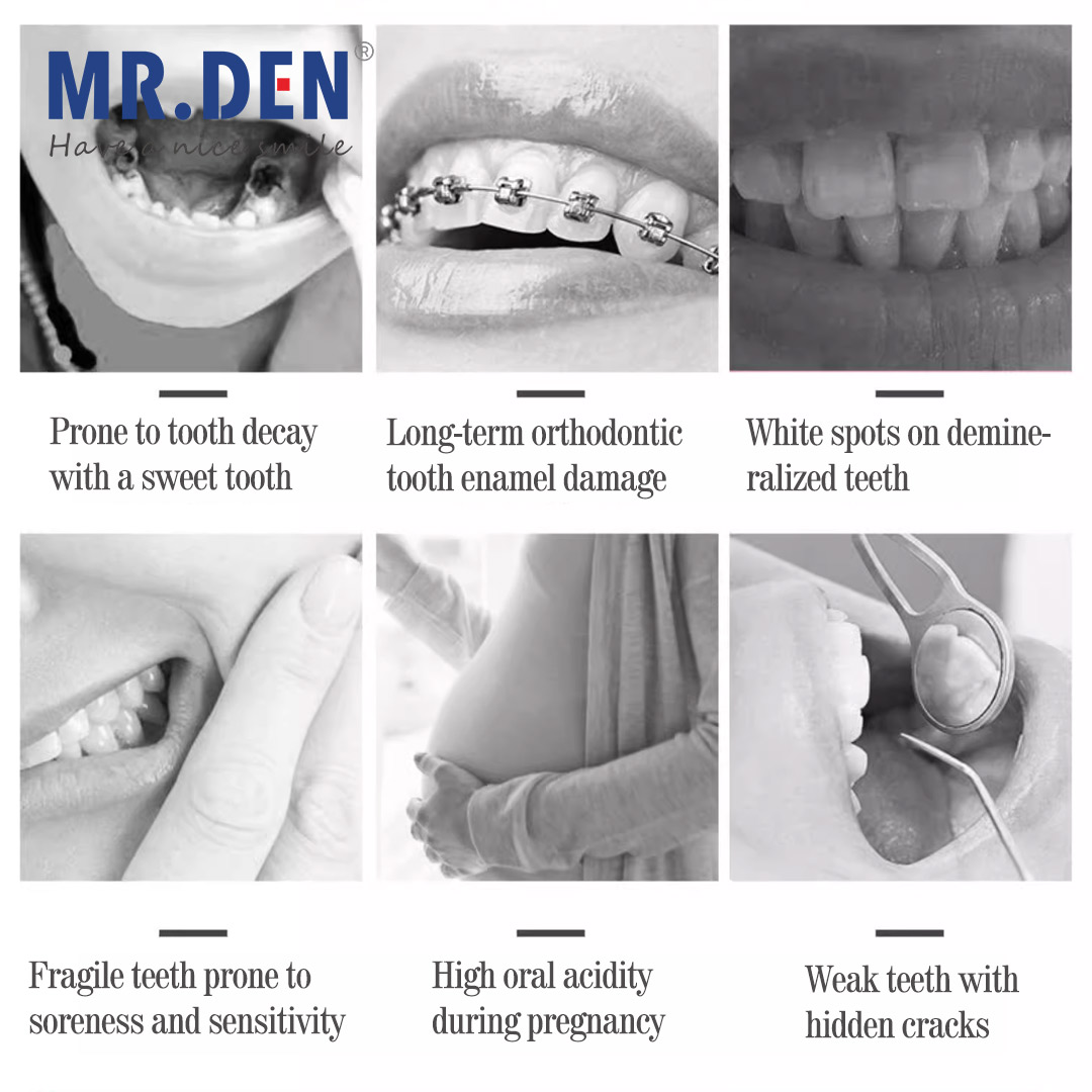 Japan GC Fluoride Enhanced Den – Teeth Whitening In Japan recenzja i cena