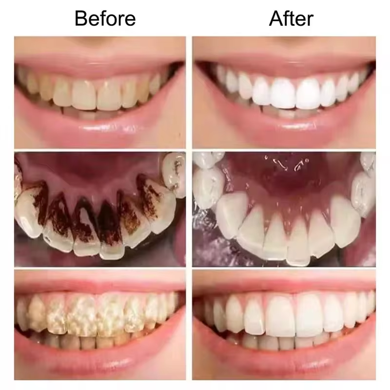 7.5% Hydroxyapatite Probiotic  – Teeth Whitening Toothpaste recenzja i cena