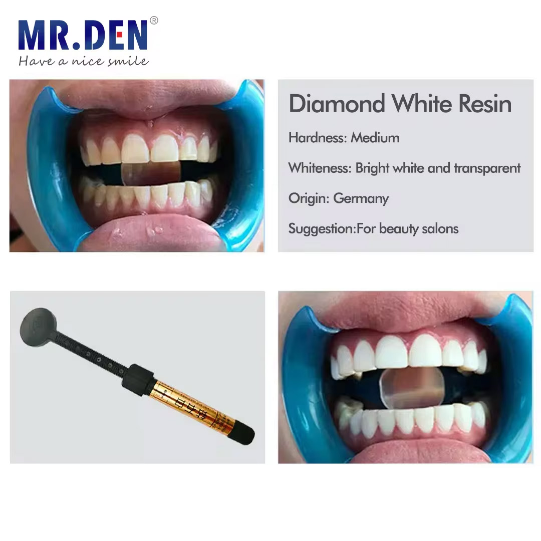 Nano enamel veneer material te – Teeth Whitening Veneers recenzja i cena