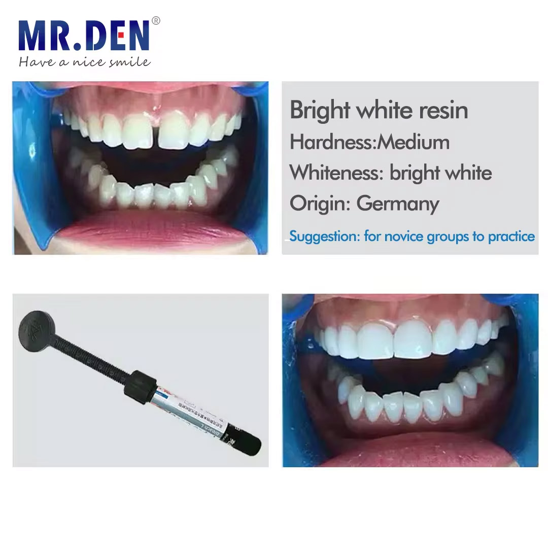 Nano enamel veneer material te – Teeth Whitening Veneers recenzja i cena
