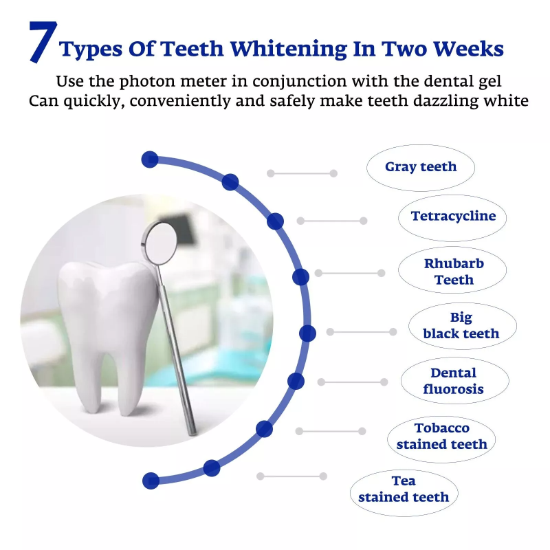 Teeth Whitening Accelerator Sm – Teeth Whitening Uv Light recenzja i cena