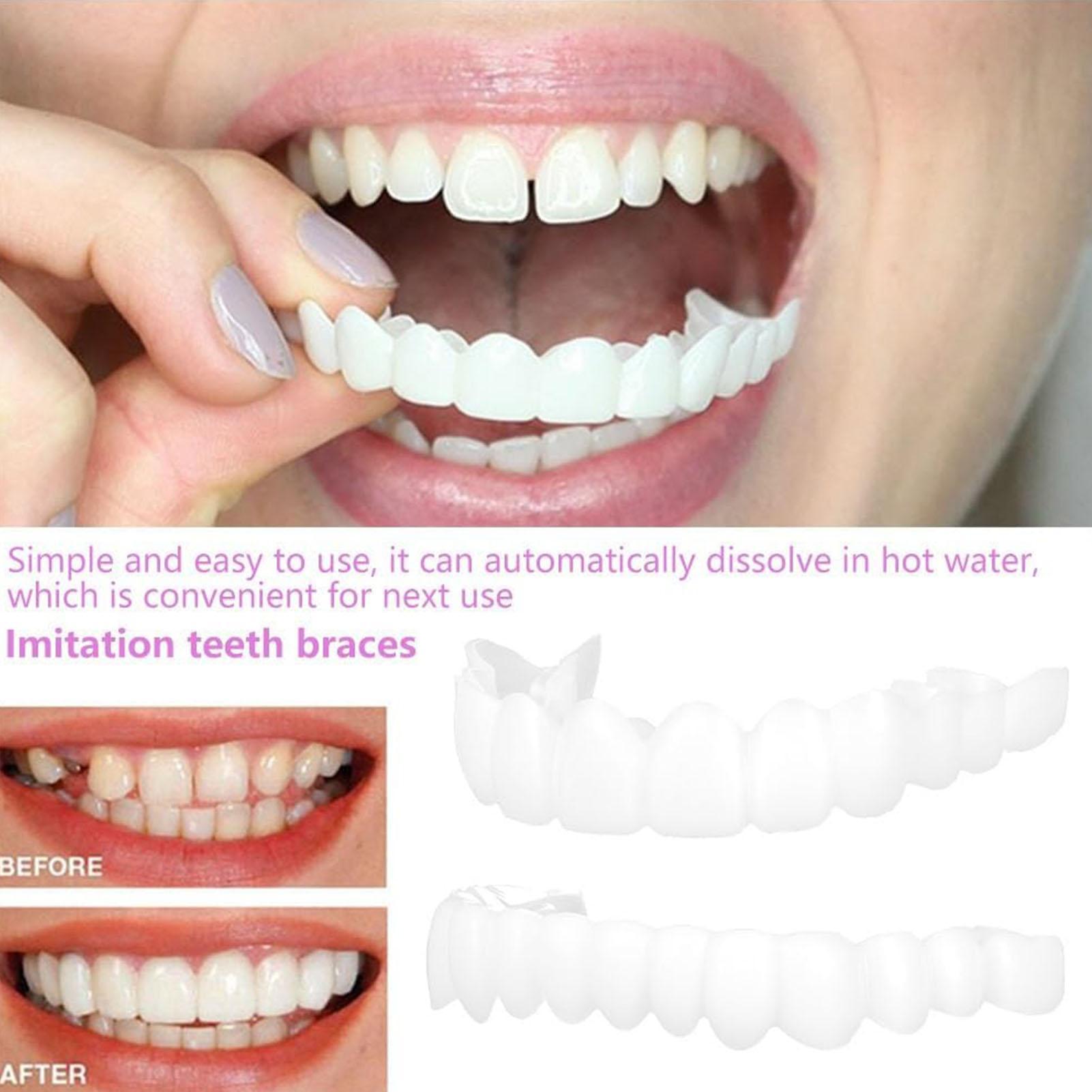 2pcs Men Women Temporary Teeth – Teeth Whitening Veneers recenzja i cena