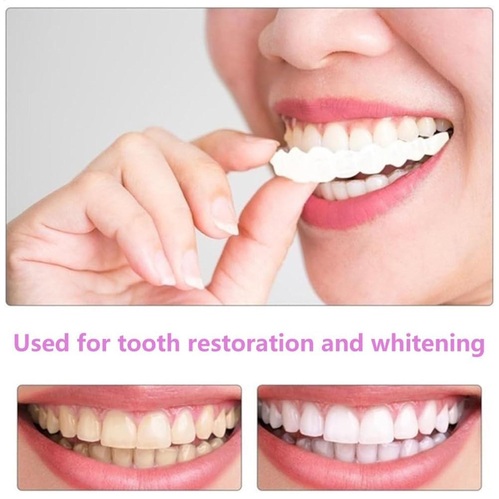 2pcs Men Women Temporary Teeth – Teeth Whitening Veneers recenzja i cena