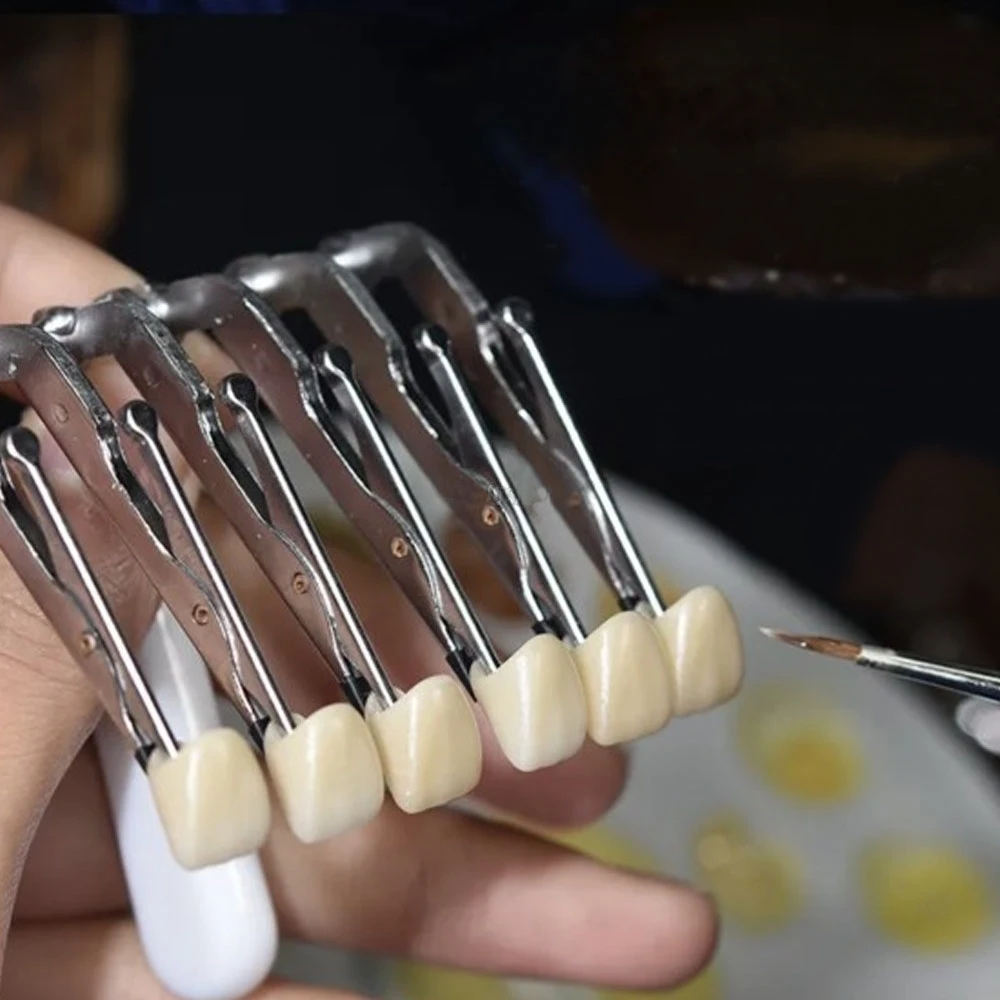 1pc Dental Veneer Porcelain Fa – Teeth Whitening Veneers recenzja i cena