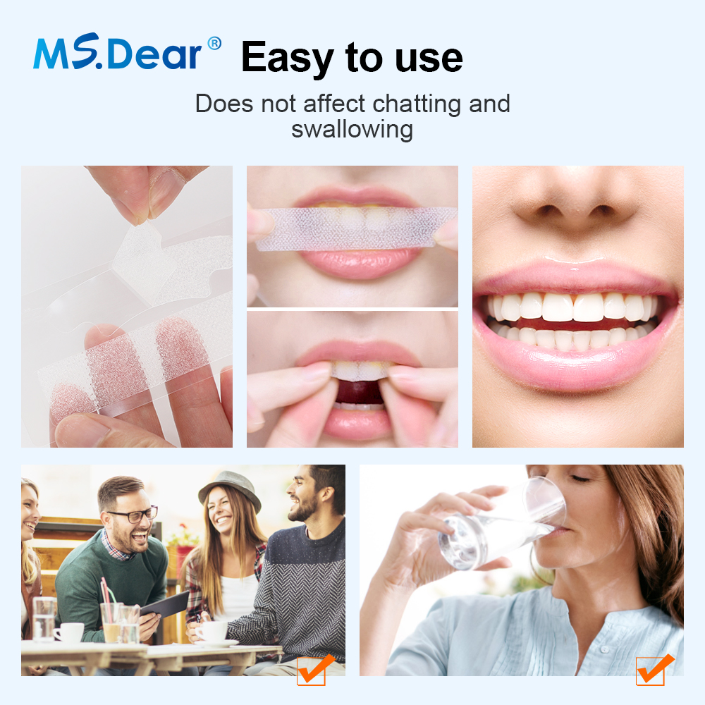 Teeth Whitening Strips Cleansi – Teeth Whitening Flash recenzja i cena
